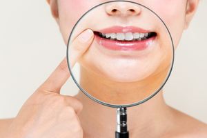 ホワイトニング治療